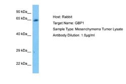 GBP1 Rabbit anti-Human, Polyclonal, Novus Biologicals 0.1 mL | Buy Online | Novus Biologicals | Fisher Scientific